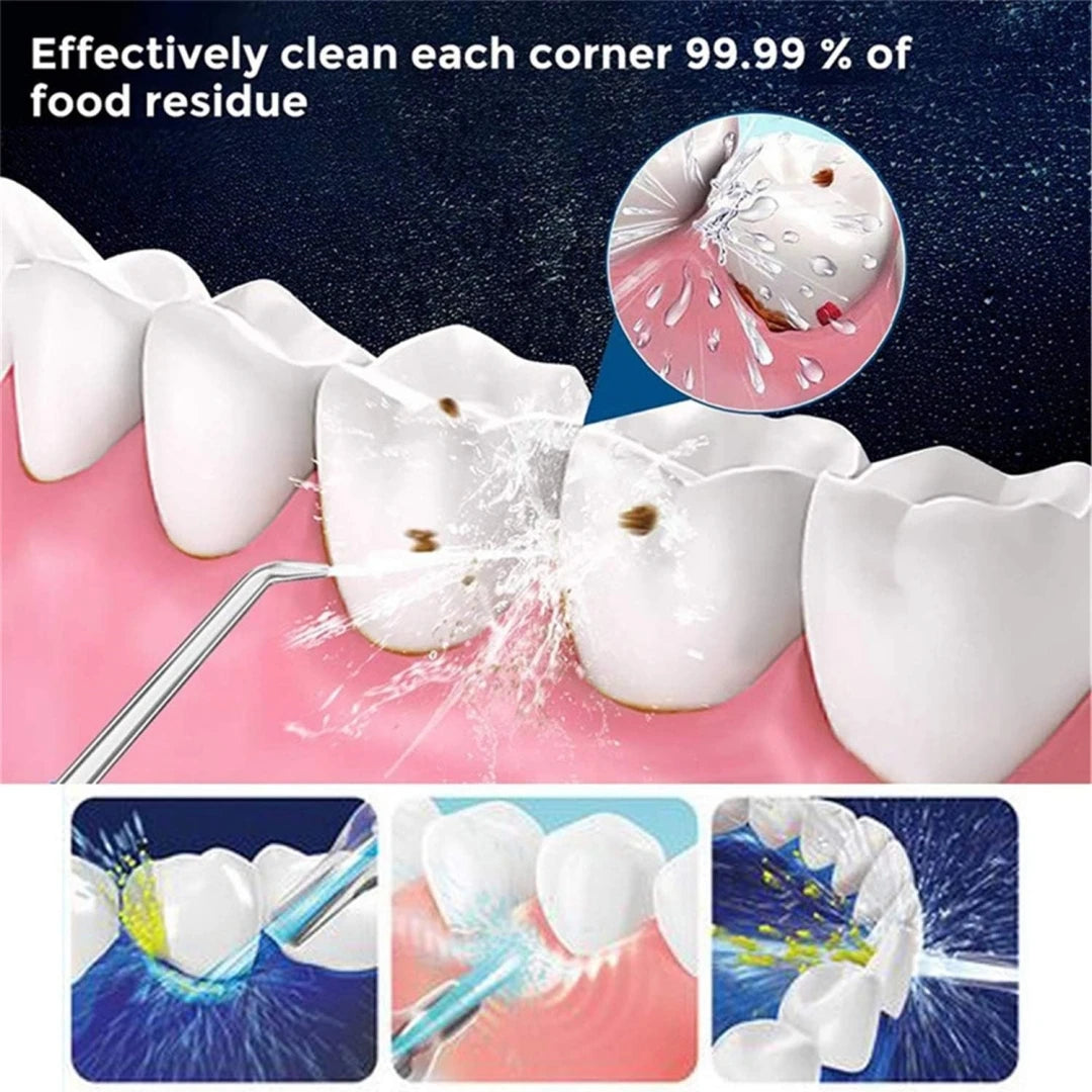 NEWLLEXX Water Flosser Hand Powered Oral Irrigator Nozzles